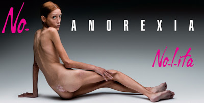Anorexia image